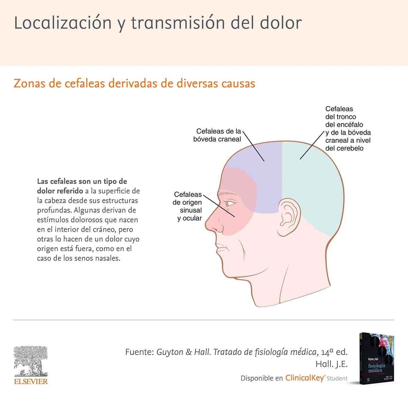 Infografia SLM Localizacion Transmision Dolor GuytonHall 3