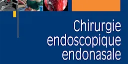 Chirurgie endoscopique endonasale