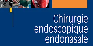 Chirurgie endoscopique endonasale