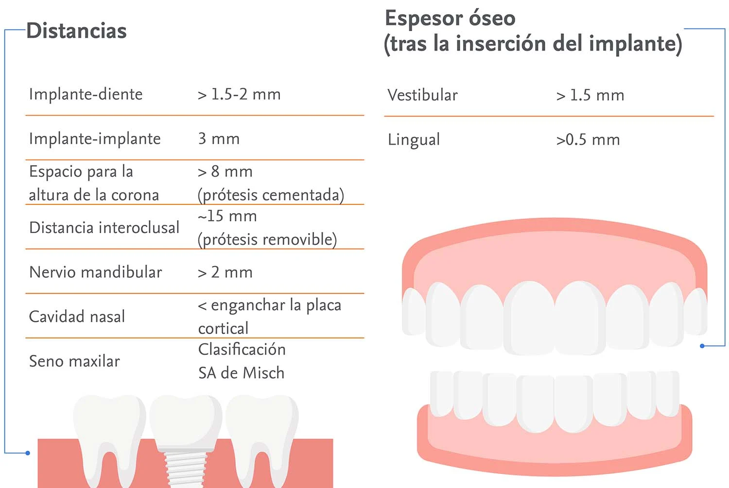 Posicion Implantes principal