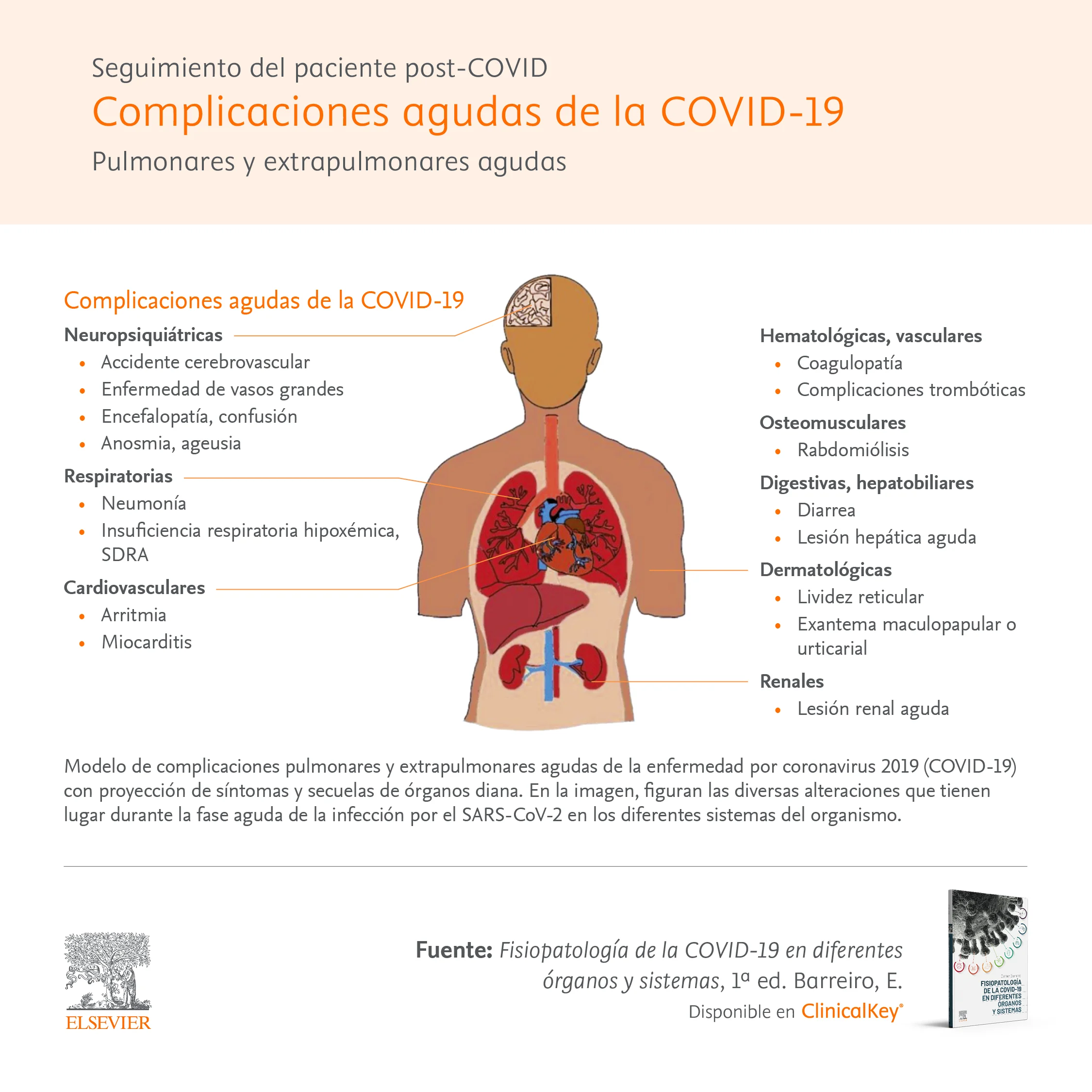 Complicaciones agudas de la COVID-19