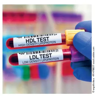 LDL Test