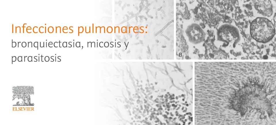 header enfermedades pulmonares 3