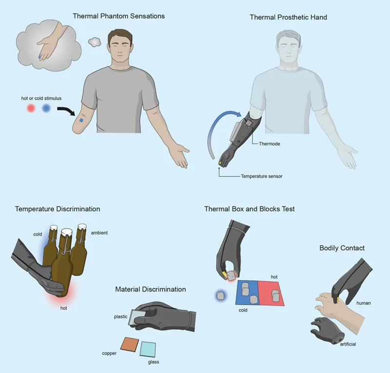 In their graphical abstract, the researchers show how their device can enable an amputee to differentiate between temperatures, materials, and artificial and human contact. (Source: Muheim and Iberite et al: Med, Feb 2024)