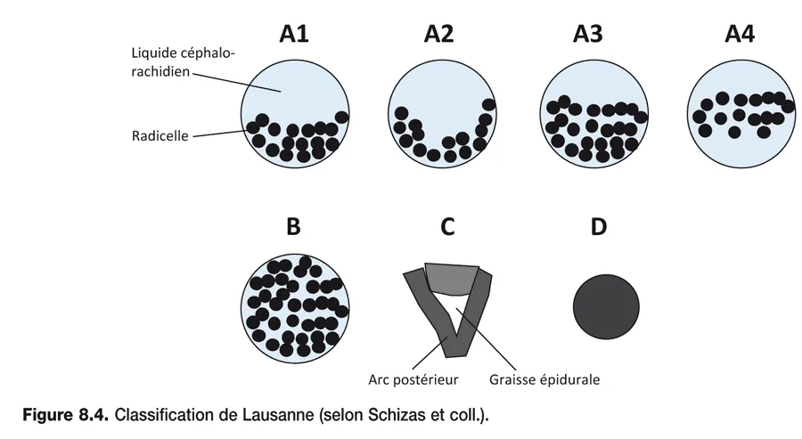 Douleurs Lombaires Raison Principale Des Arr ts De Travail douleurs-lombaires-raison-principale-des-arr-ts-de-travail