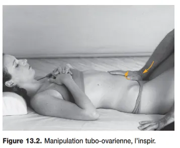 Fig 13.2 Manipulations tubo-ovariennes