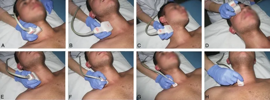 Position des sondes pour l'examen des troncs supra-aortiques