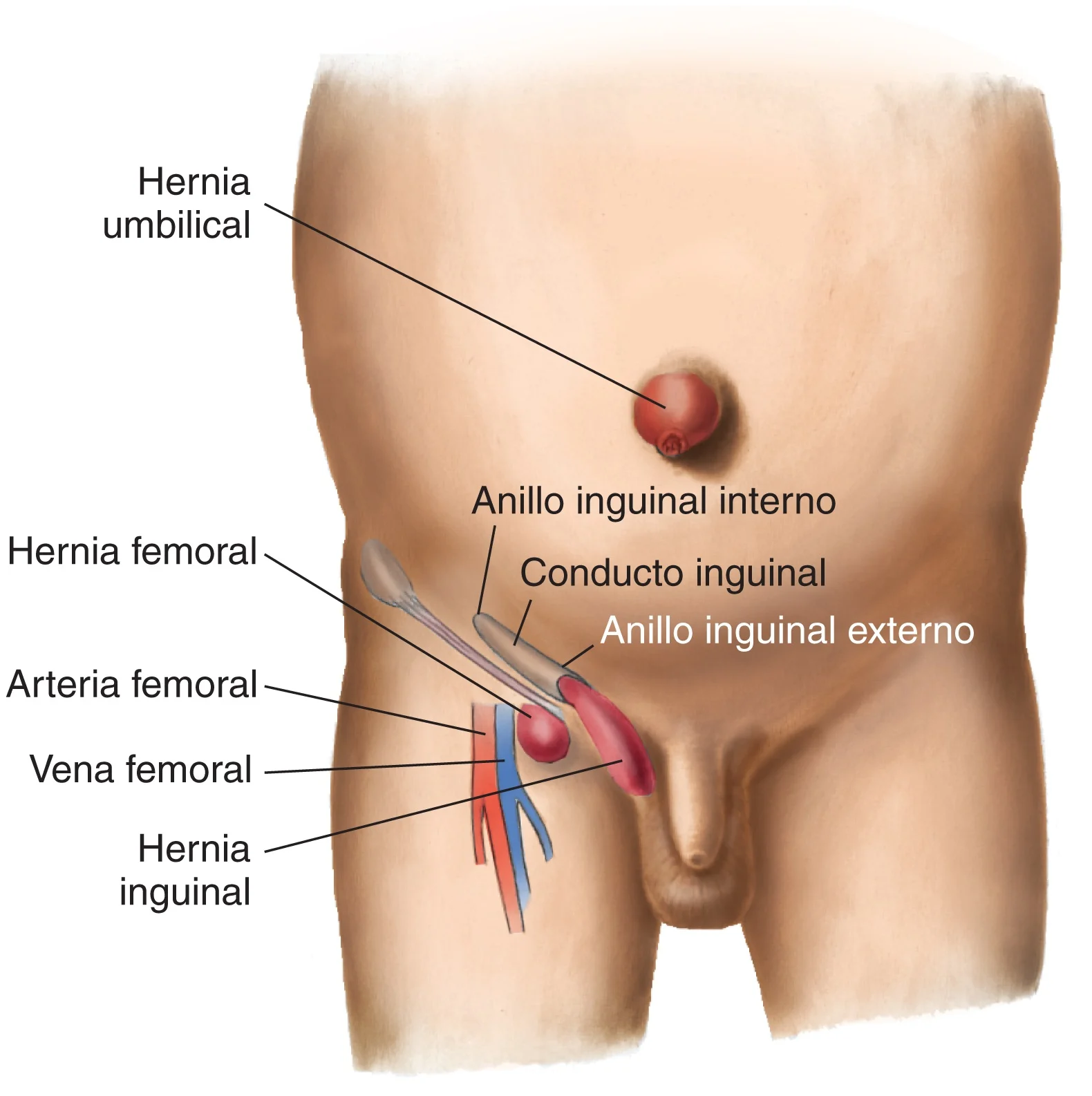 Localización de la hernias internas y externas