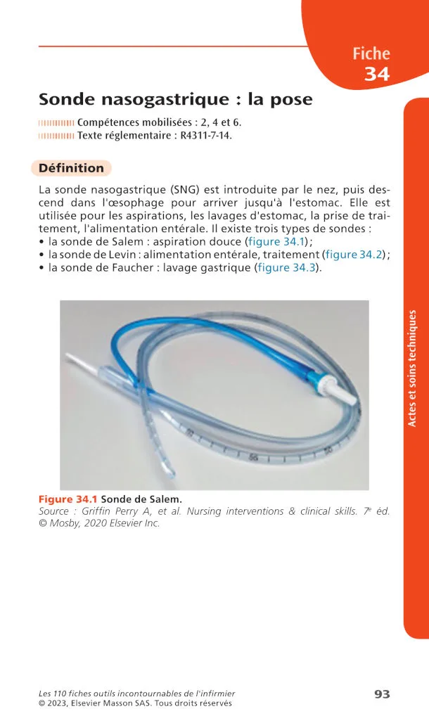 Fiche 34  Sonde nasogastrique : la pose