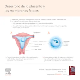 Infografia SLM Placenta Moore