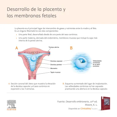 Infografia SLM Placenta Moore