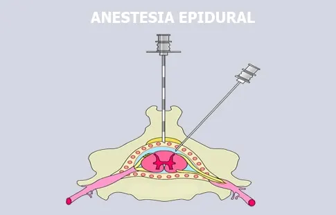 Anestesia Principal