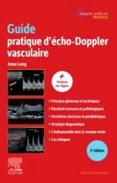 Guide pratique d-écho-Doppler vasculaire