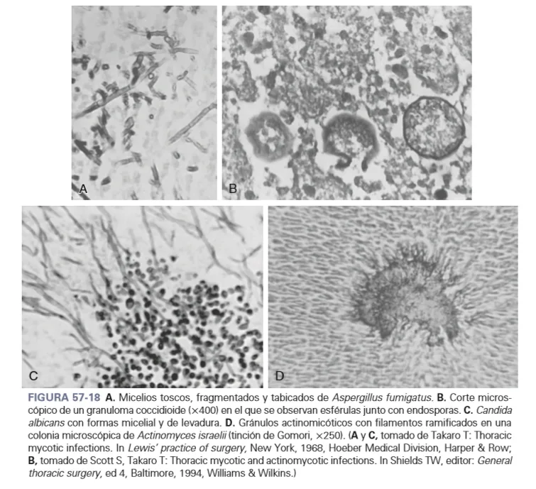 Parasitosis