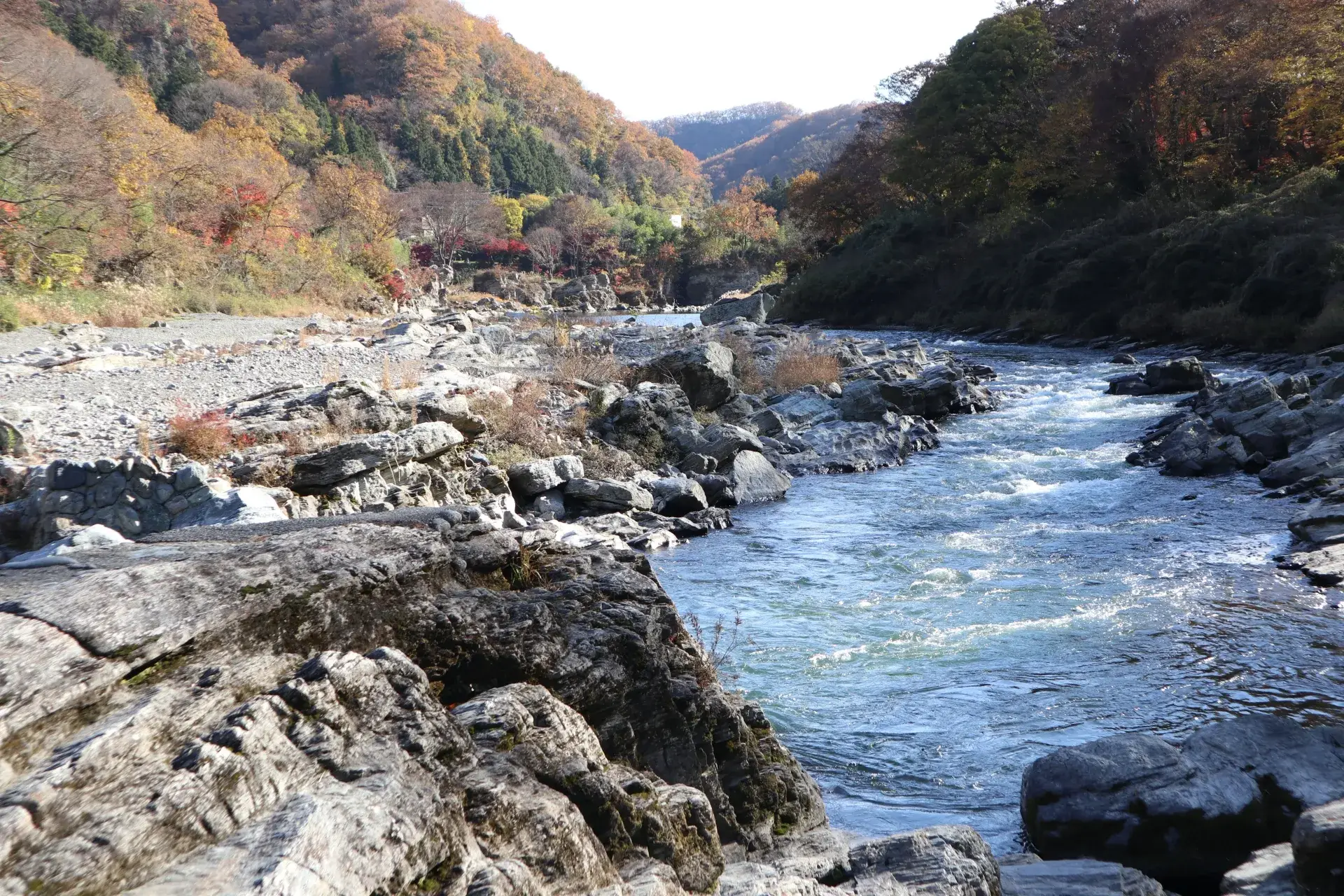 樋口でおすすめの歯科矯正医院3選！選ぶ際に抑えるべきポイントもご紹介