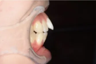治療前の症例写真