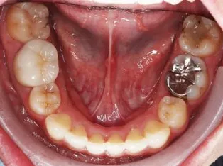 治療後の症例写真