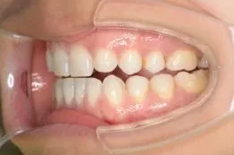 治療前の症例写真
