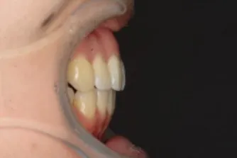 治療後の症例写真