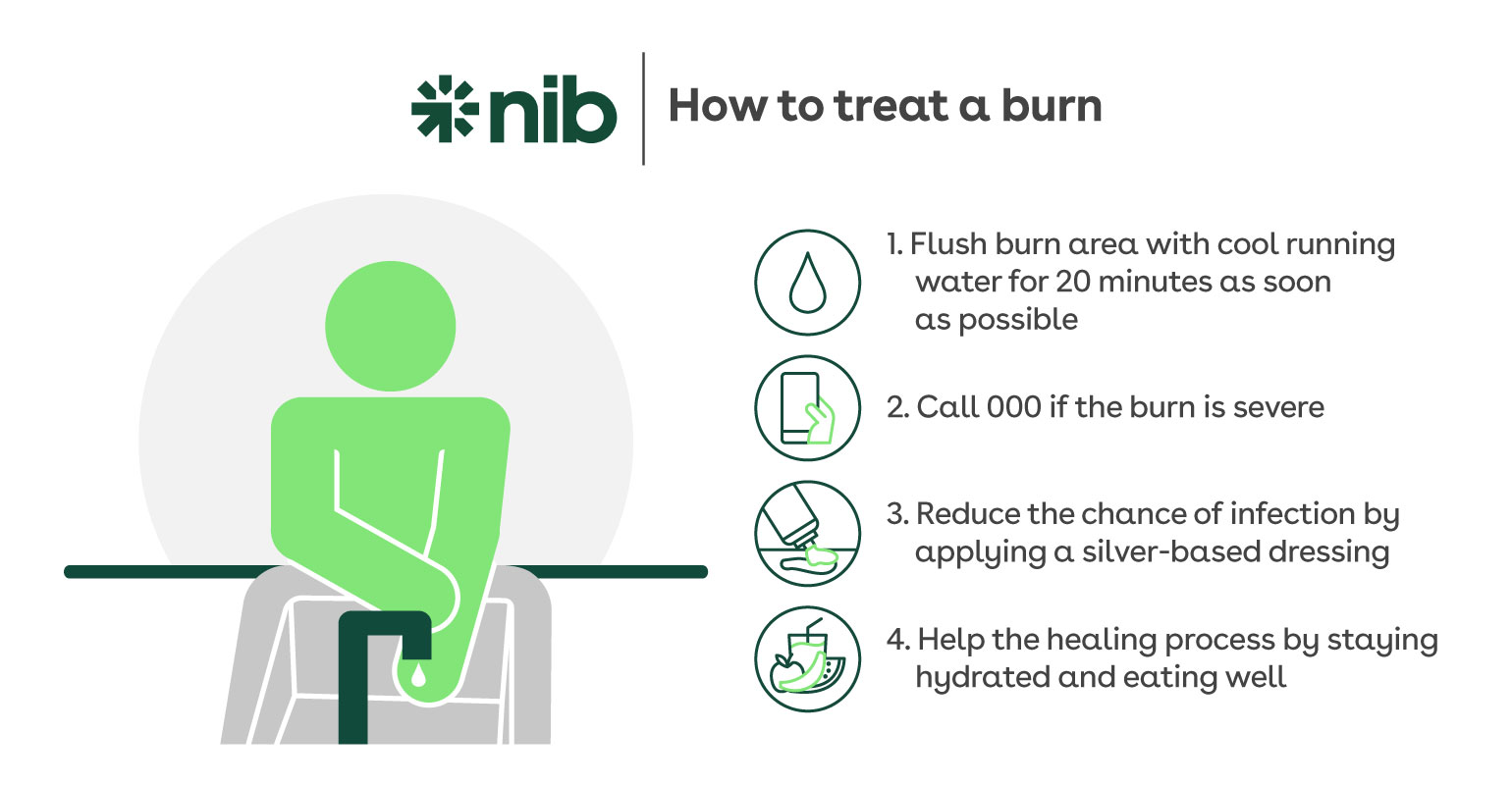 An infographic outlining how to treat a burn.