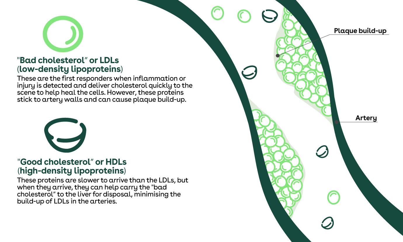 Infographic showing how cholesterol affects the arteries.