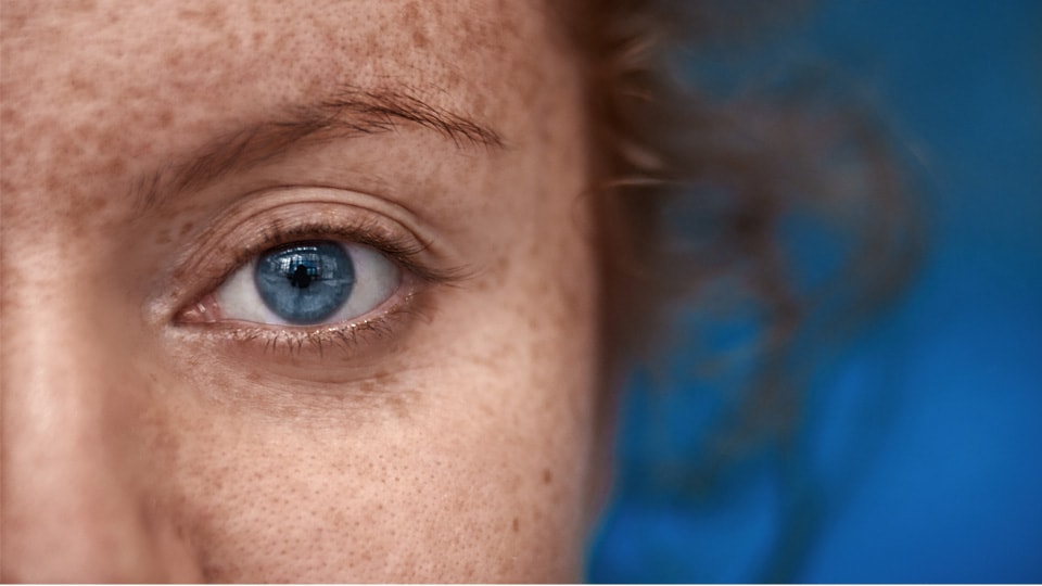 A close-up of a woman's blue eye with floating spots.