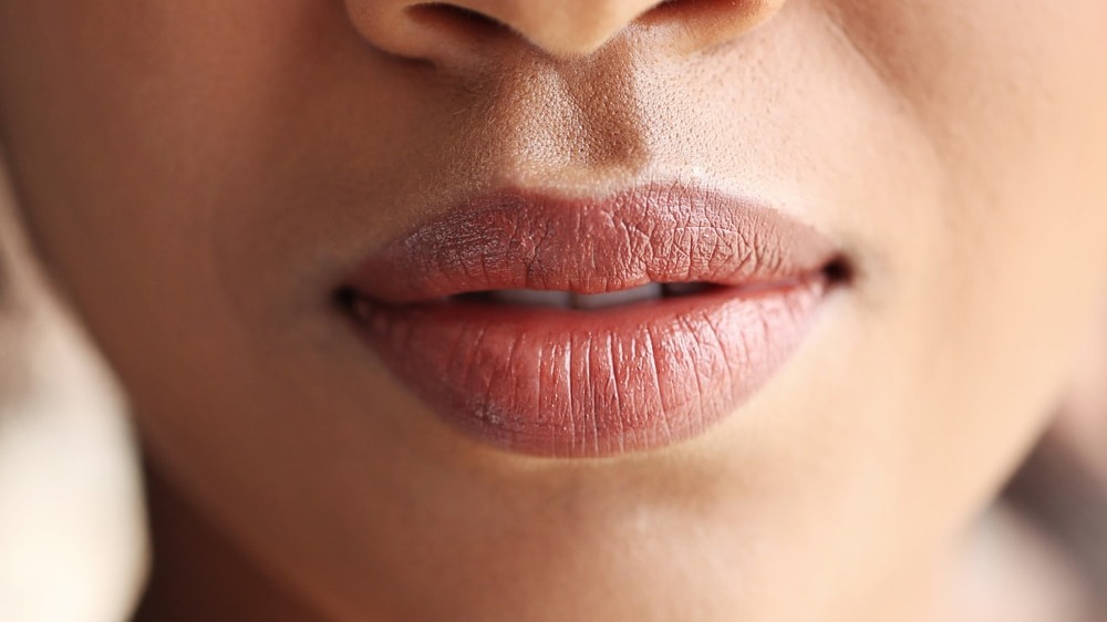 Why Cupid's Bow Procedures Are The Next Generation Of Lip Augmentation