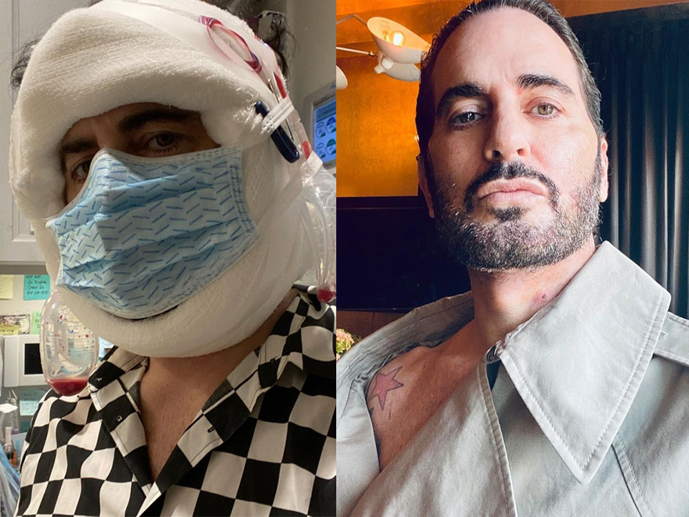 Marc Jacobs Is Ready for Lewks After Documenting His Facelift