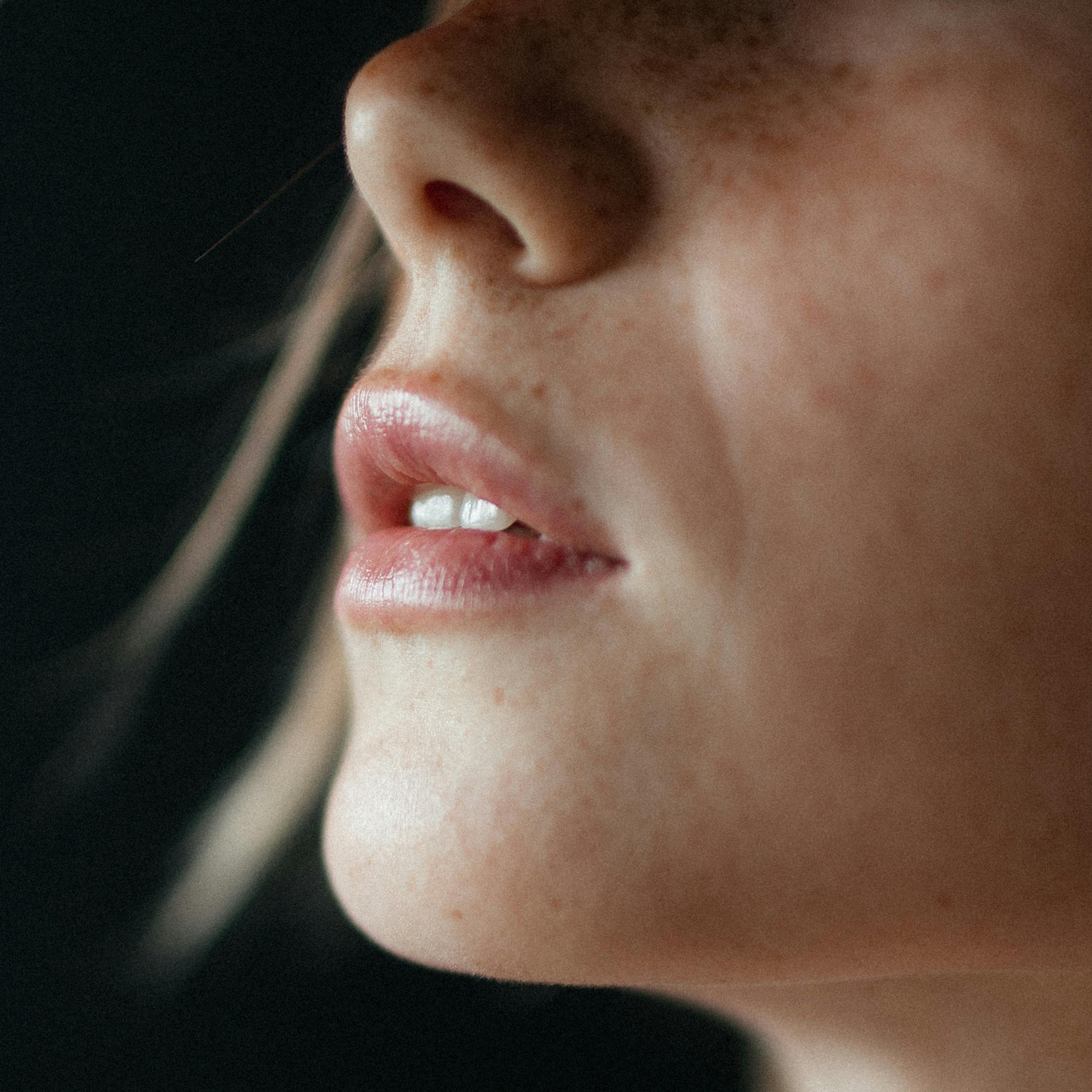 Dermal Filler Treatment