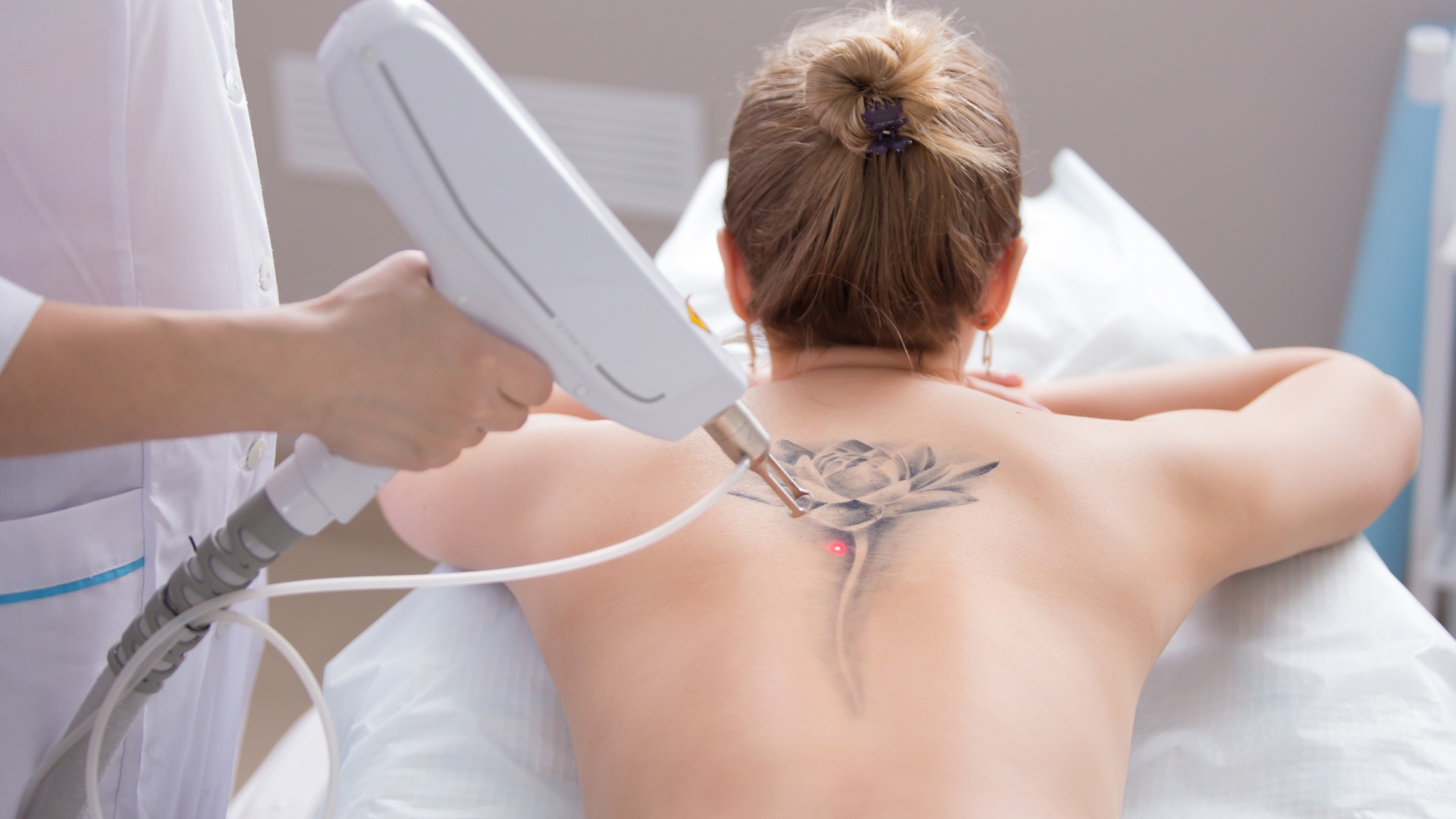 Laser Tattoo Removal in West Hollywood  CRMC