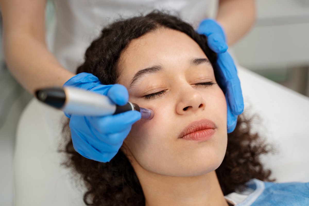 Imagen destacada del post Microneedling facial: ¿Cómo ayuda a rejuvenecer la piel?