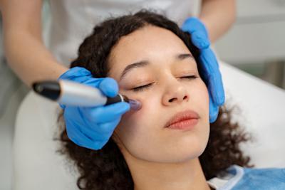 Imagen destacada del post: Microneedling facial: ¿Cómo ayuda a rejuvenecer la piel?