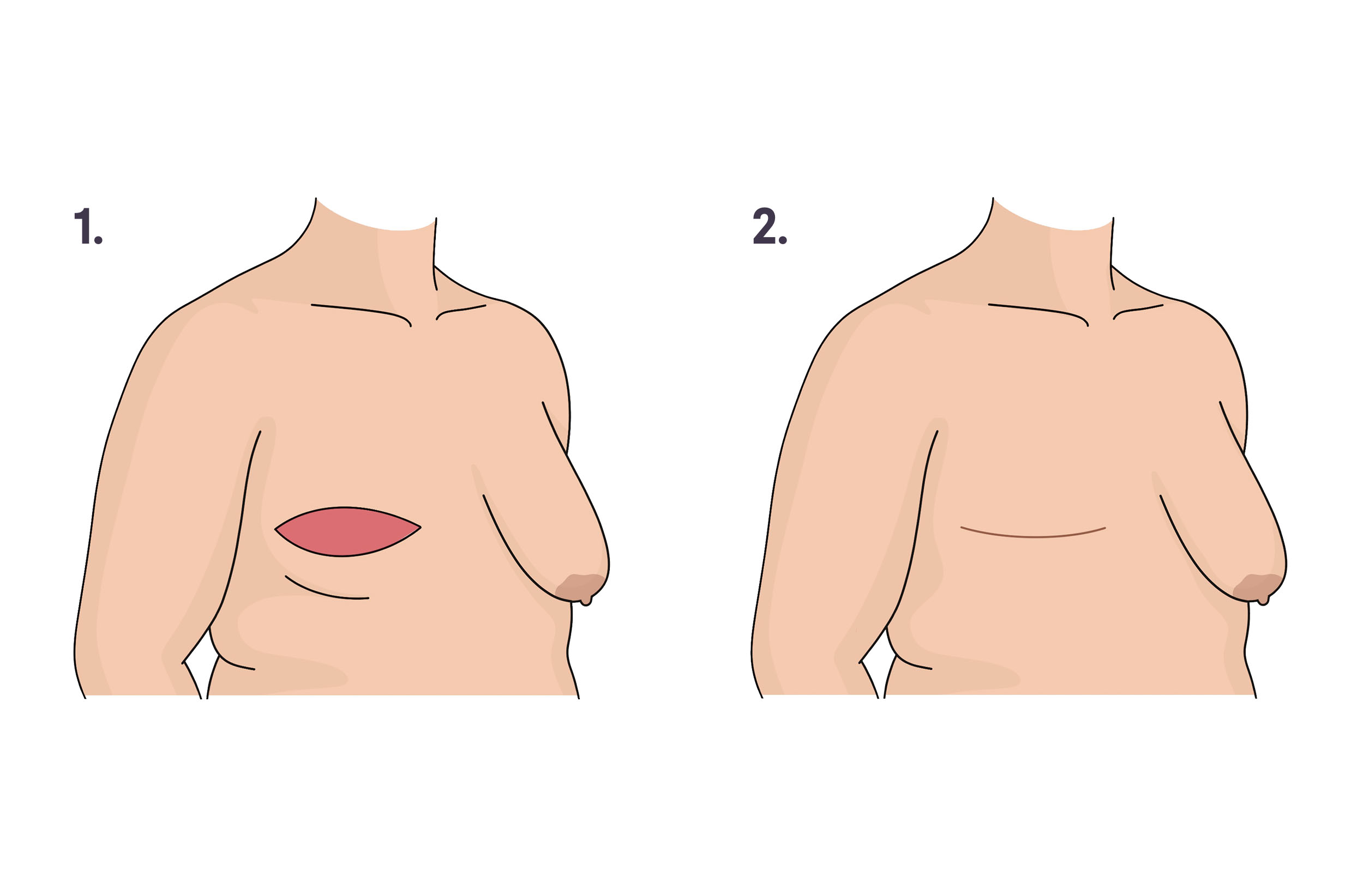 Aesthetic Flat Closure Image file