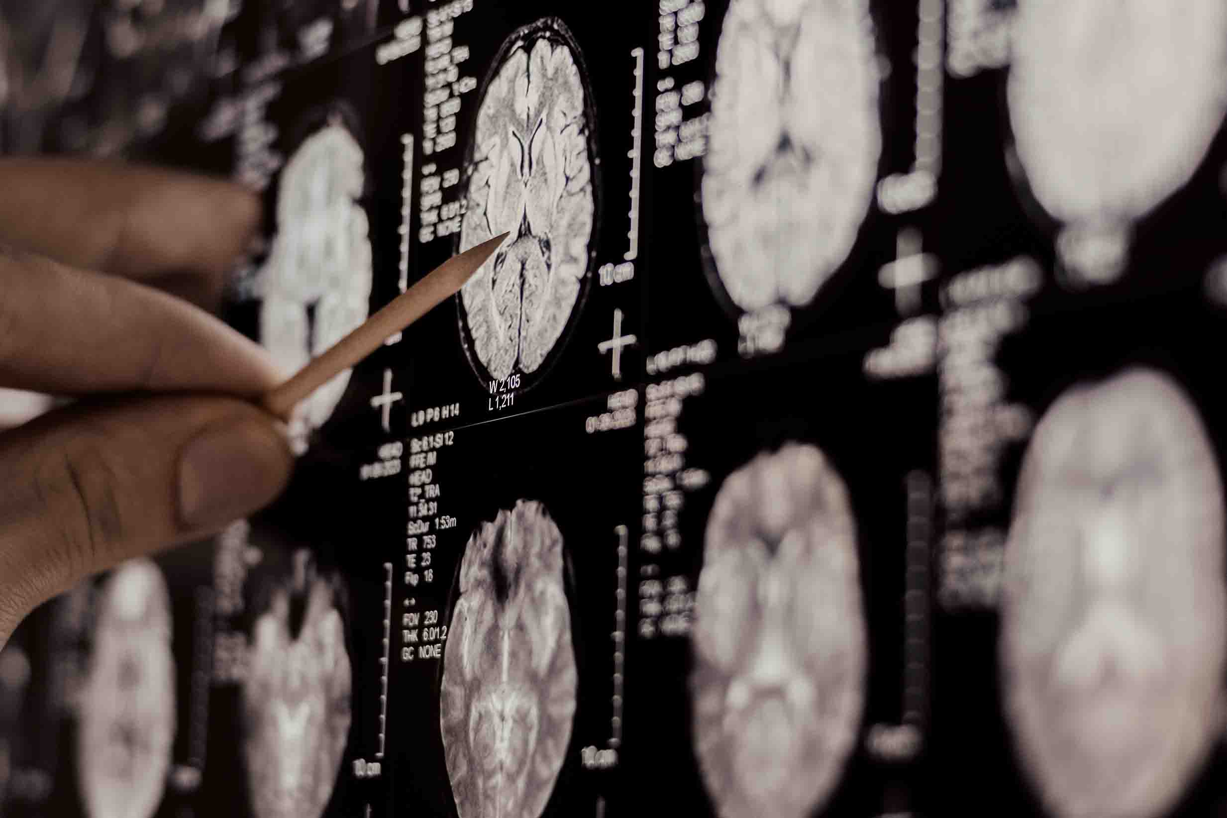 Lepto Proton news story image