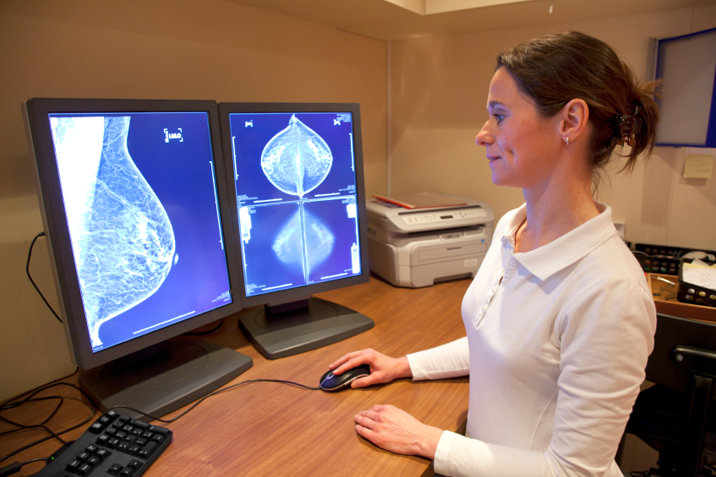 Woman looking at mammogram scan on computer