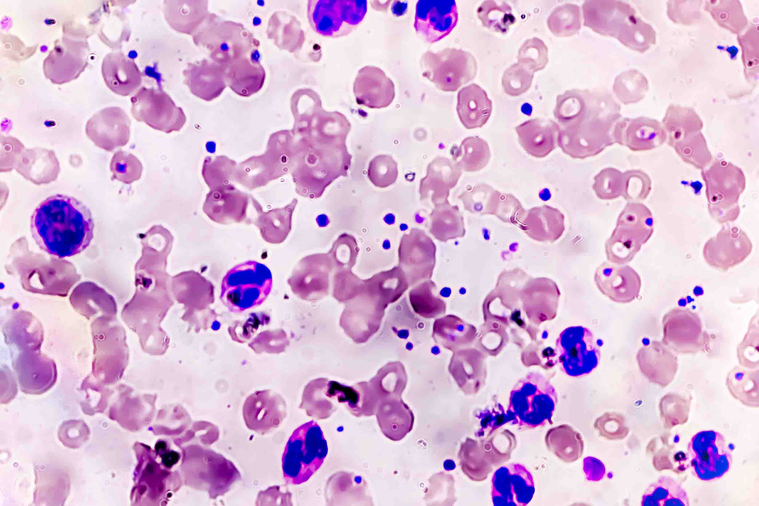 Neutrophils 2466x1644