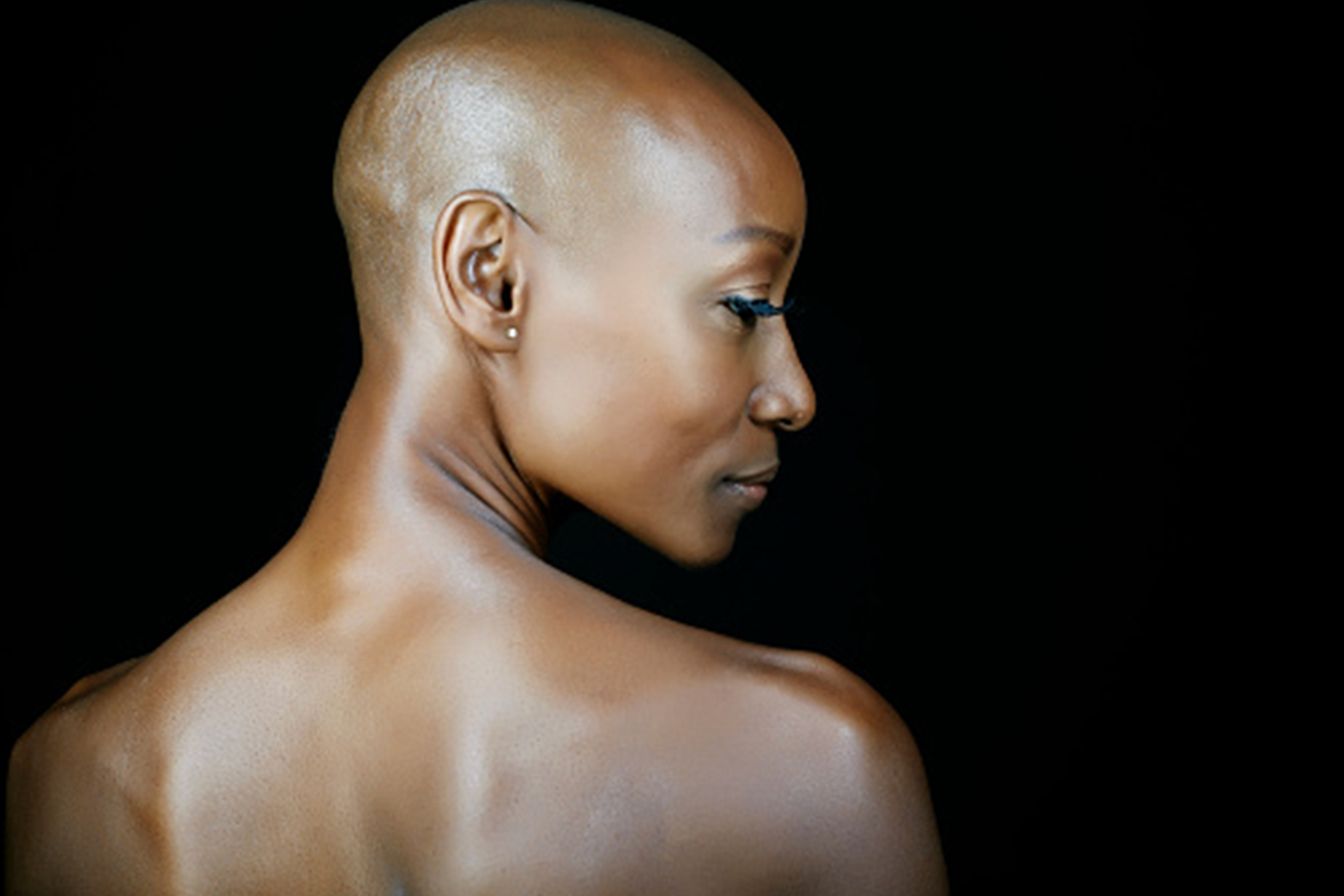 Bald woman from back with bare skin