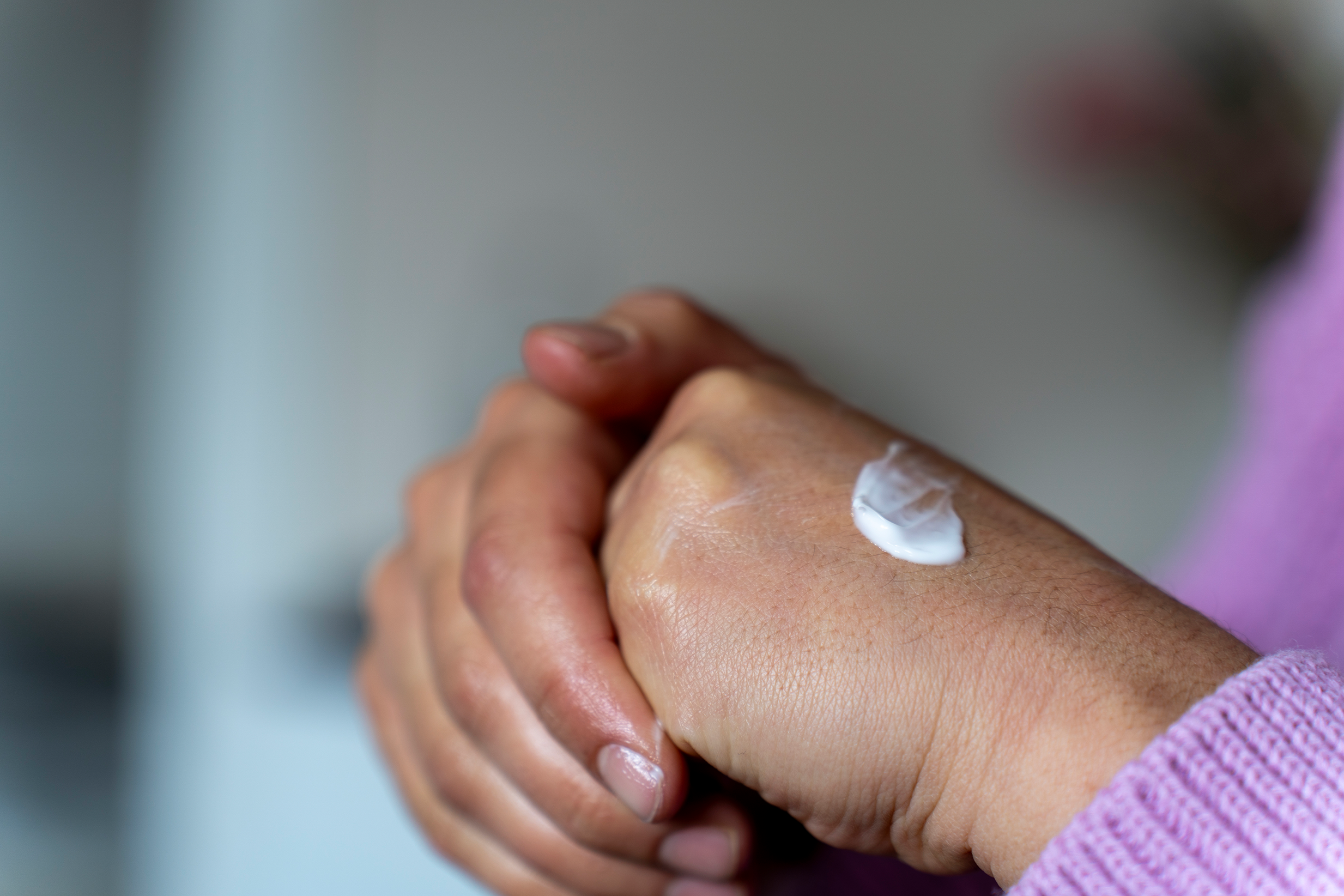 CreamNeuropathy 2466x1644