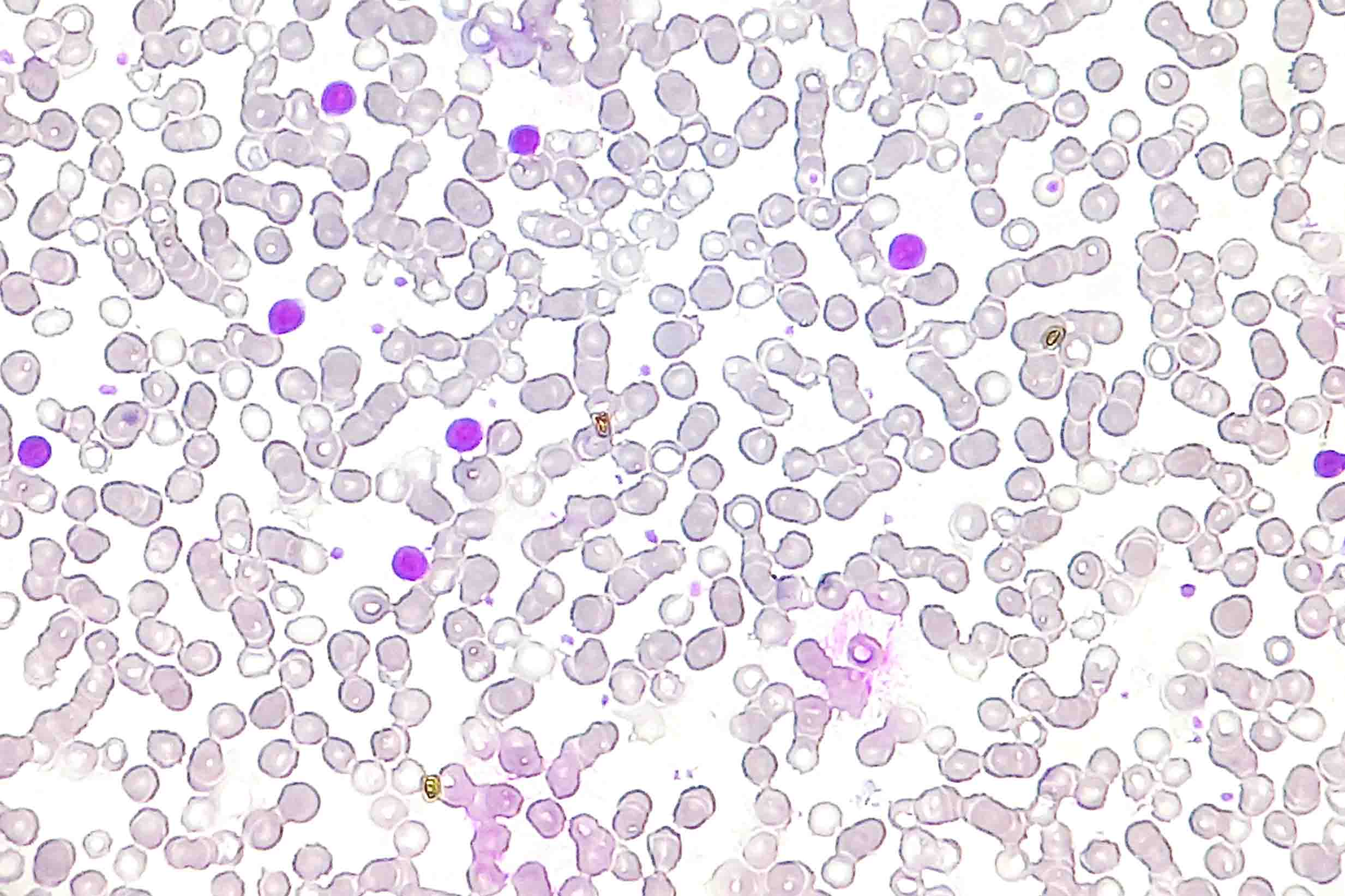 TNBCImmuneCells 2466x1644