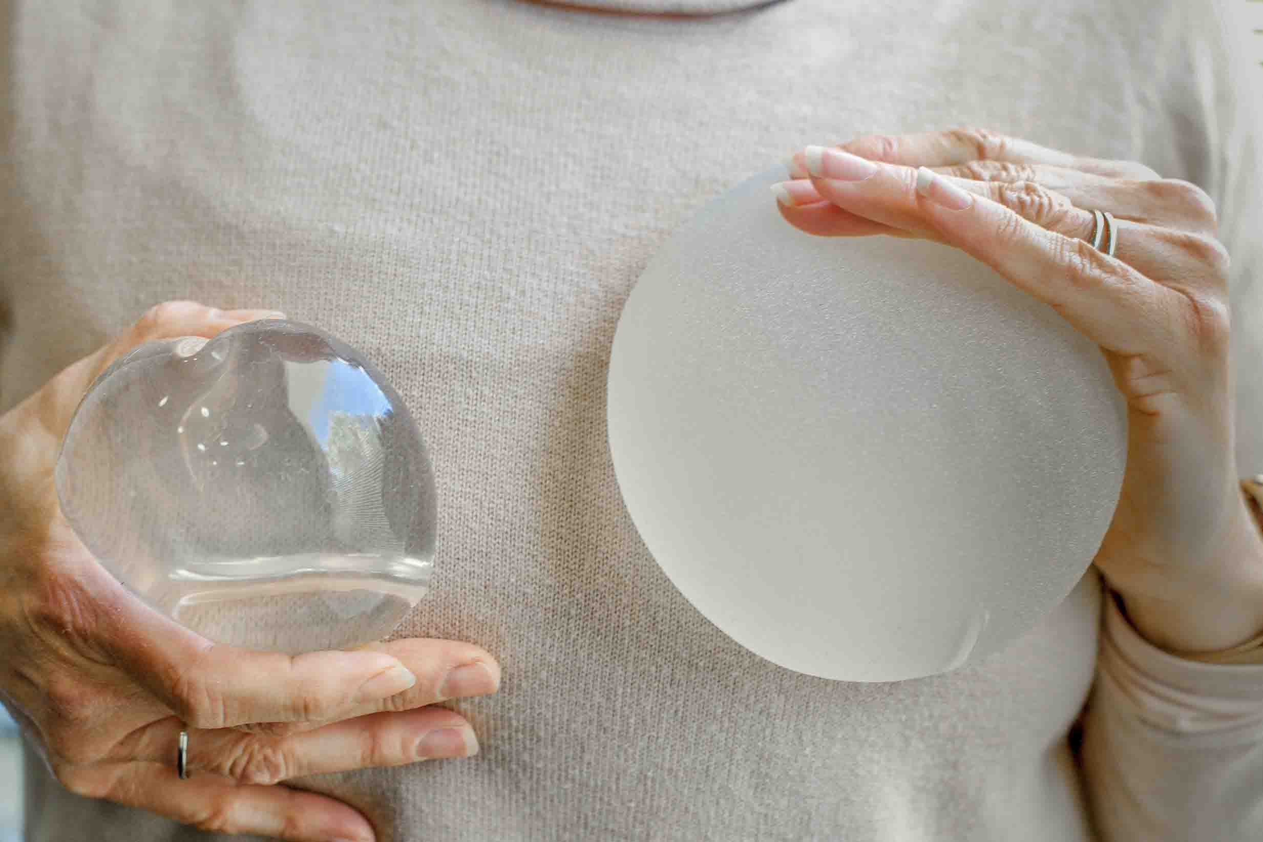 BRCA mutations up the risk of BIA-ALCL image