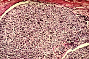 Breast Cells